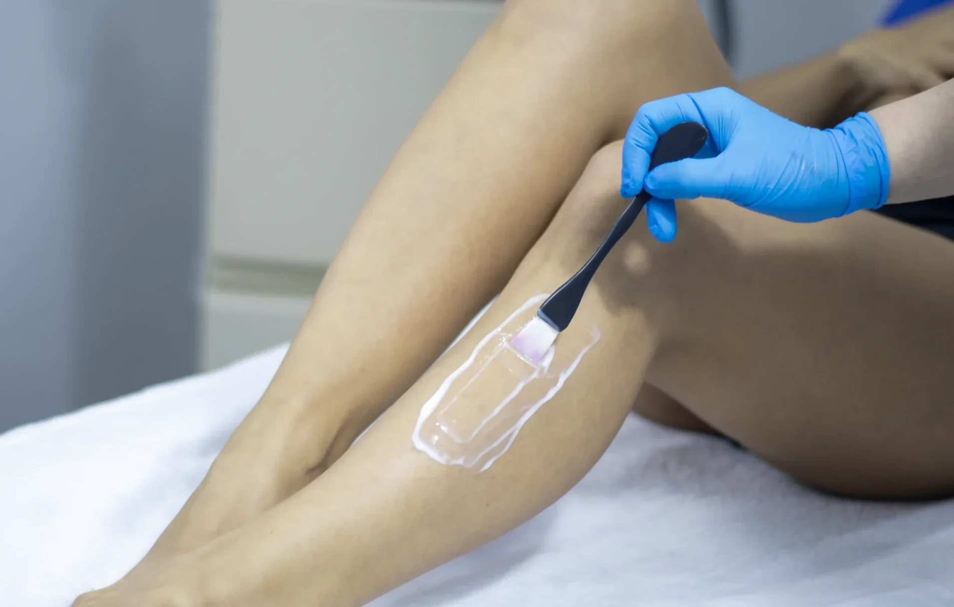 Tratamiento Estético